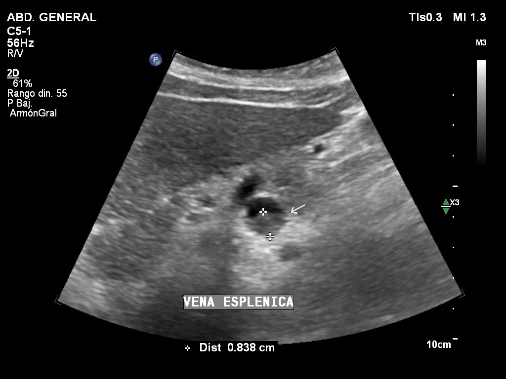 José S. Vaque Ramírez, MD tweet media