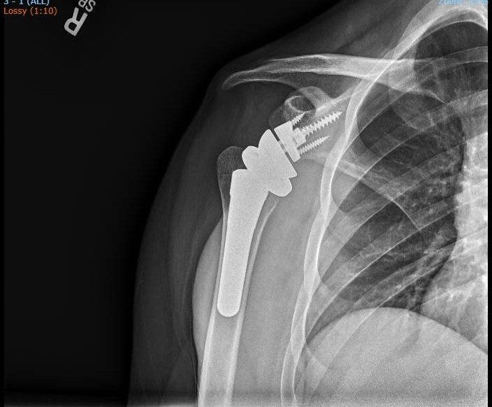 Peter Wrangel tweet media