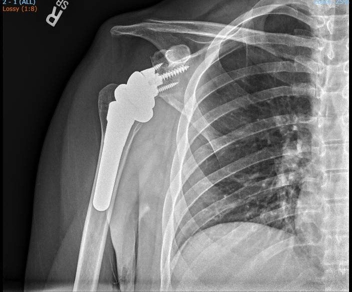 Peter Wrangel tweet media