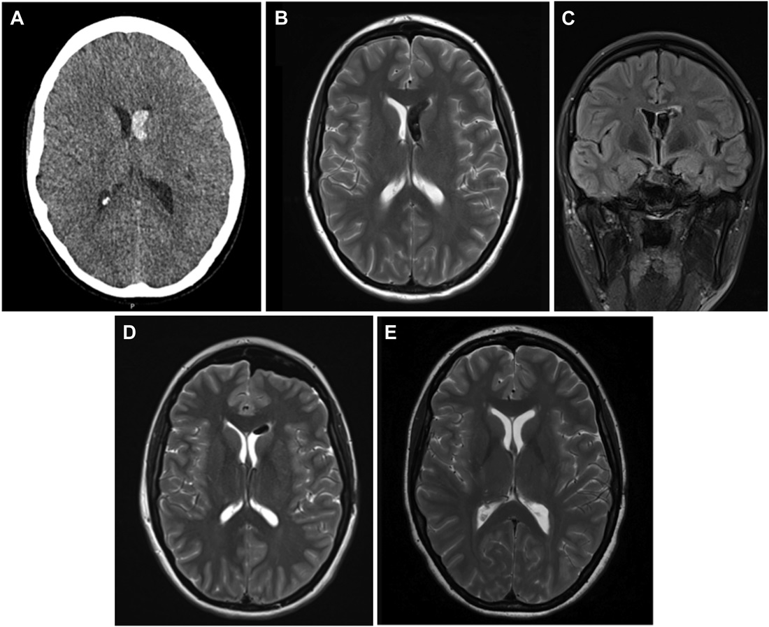 Visish M. Srinivasan, MD tweet media