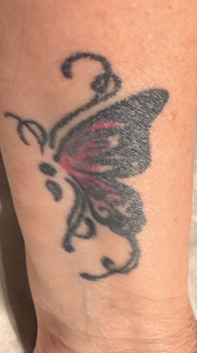 Tall Tree tweet media