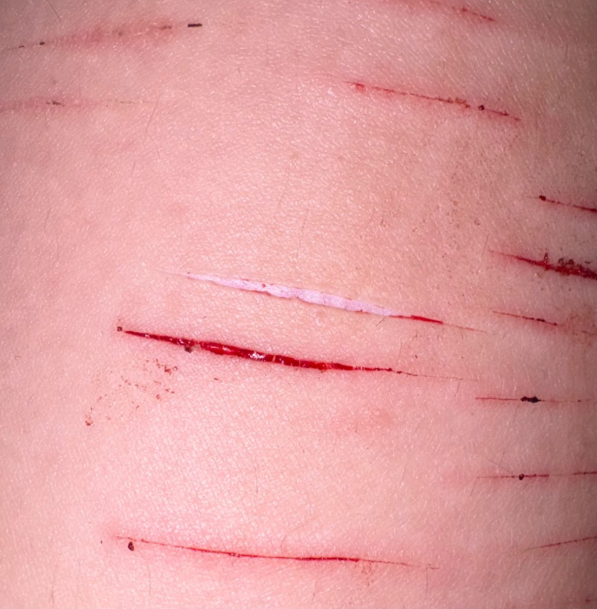 louie of shedtwt tweet media