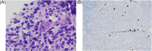 JPGN Reports tweet media