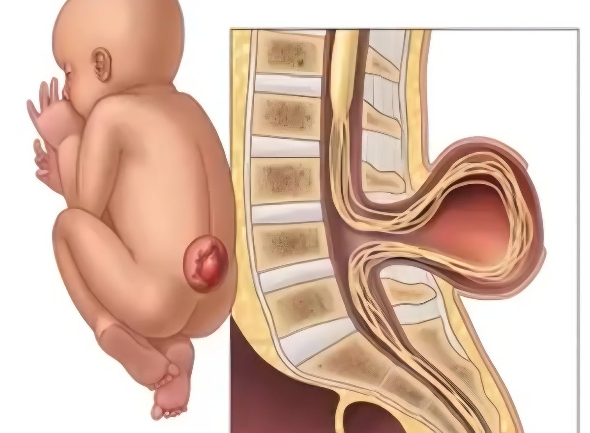 Dr_sani Rx 💉💊🔬 tweet media