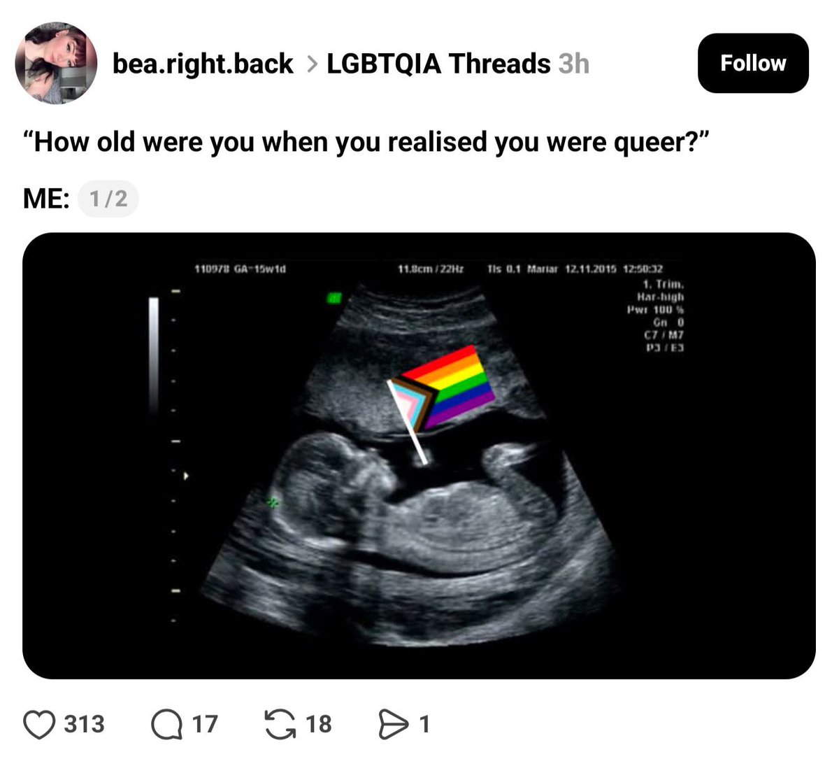 Moron Mine ⛏️ tweet media