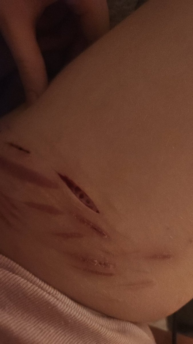 ⋆˚꩜｡𝕧an illa⸆⸉ ୨ৎ {shedtwt}⊹ ࣪ ˖ tweet media