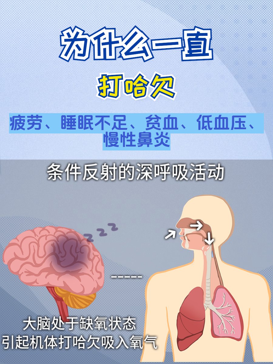 Ronyhandsboy tweet media