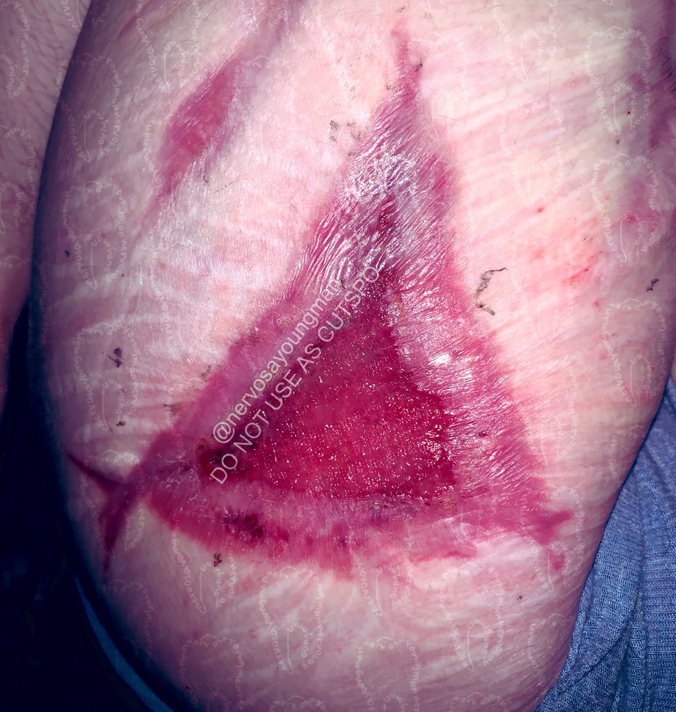 🦴 ELIJAH ⛧ -16 DNI. 🚫 tweet media