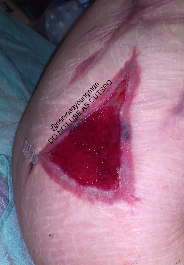 🦴 ELIJAH ⛧ -16 DNI. 🚫 tweet media