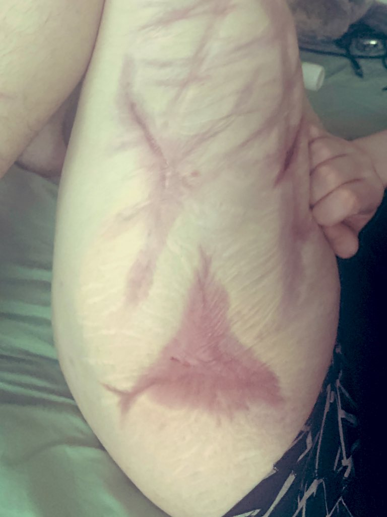 🦴 ELIJAH ⛧ -16 DNI. 🚫 tweet media