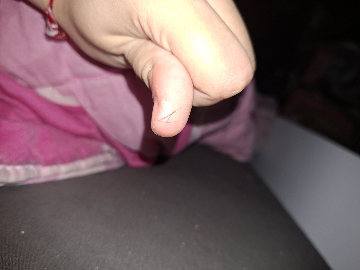 Shuriken of shedtwt tweet media