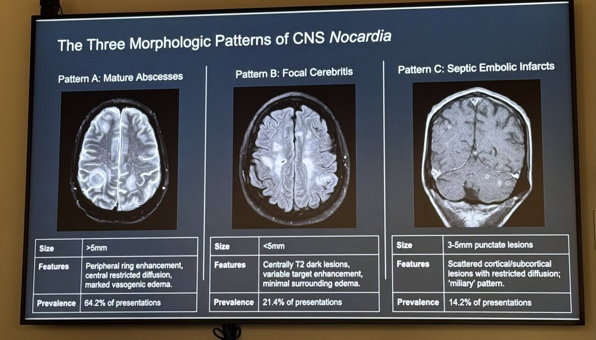 ccf_idfellows's tweet photo. Dr. Isada’s MRI workshop breaks down CNS infections into practical imaging frameworks to recognize patterns, refine the differential, and integrate radiologic findings with clinical context. 
High-yield Neuro-ID teaching at its best! #IDTwitter #NeuroID #MedEd https://t.co/G8zy6mcGum