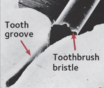 D Dアシタカ@パチスロ必勝本🦷 tweet media