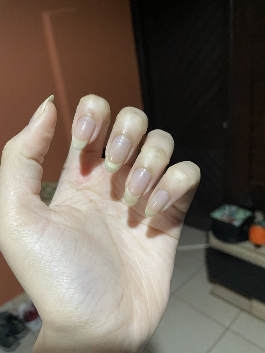 mille ˎˊ˗ (-12/32) tweet media