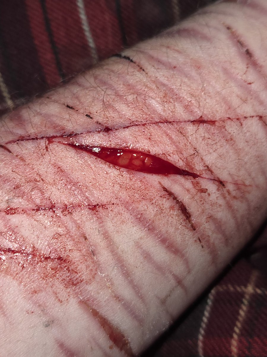 ℍ𝕒𝕔𝕙𝕚𝕨𝕒𝕣𝕖𝕤𝔹𝕚𝕘𝕋𝕠𝕖 (shtwt) tweet media