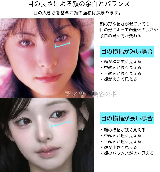 アンサー美容外科 tweet media