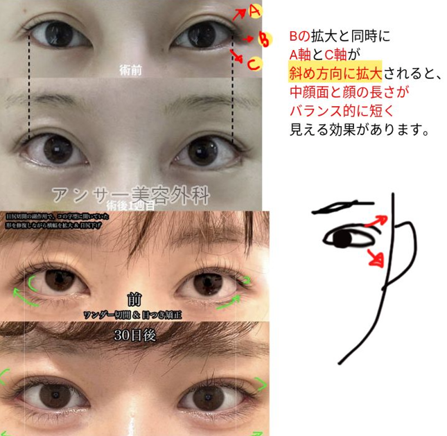 アンサー美容外科 tweet media