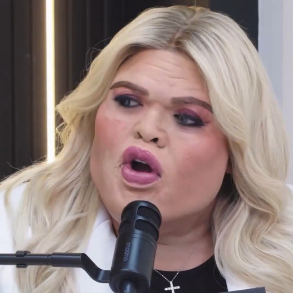 Turbo🐺 tweet media