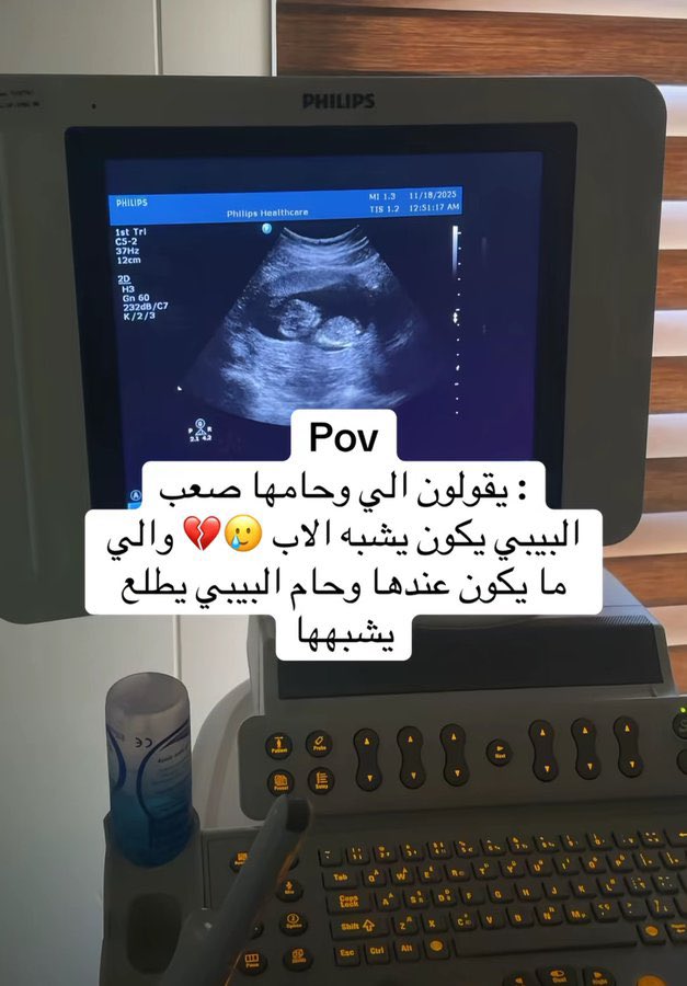 اللّيـــو tweet media