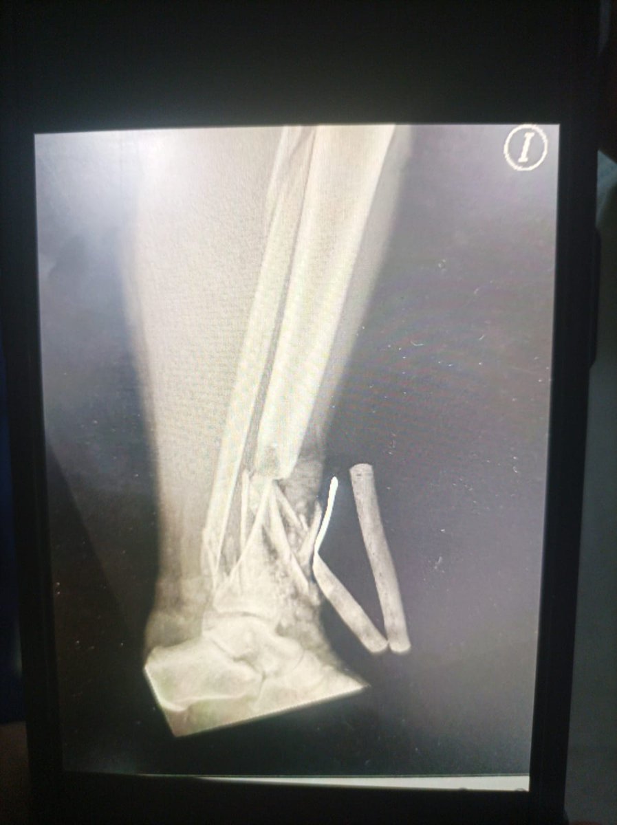 Denuncias Antioquia tweet media