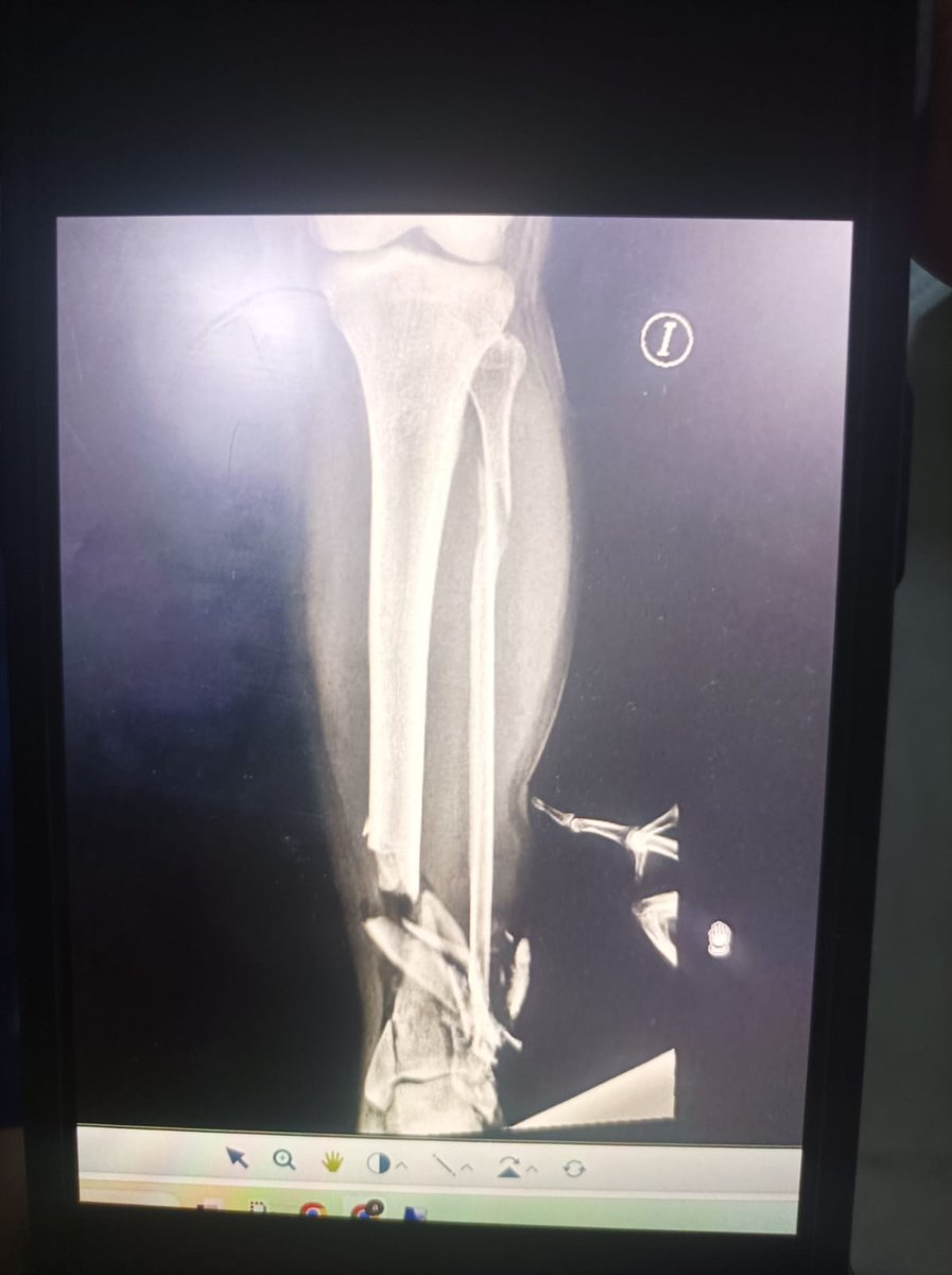 Denuncias Antioquia tweet media