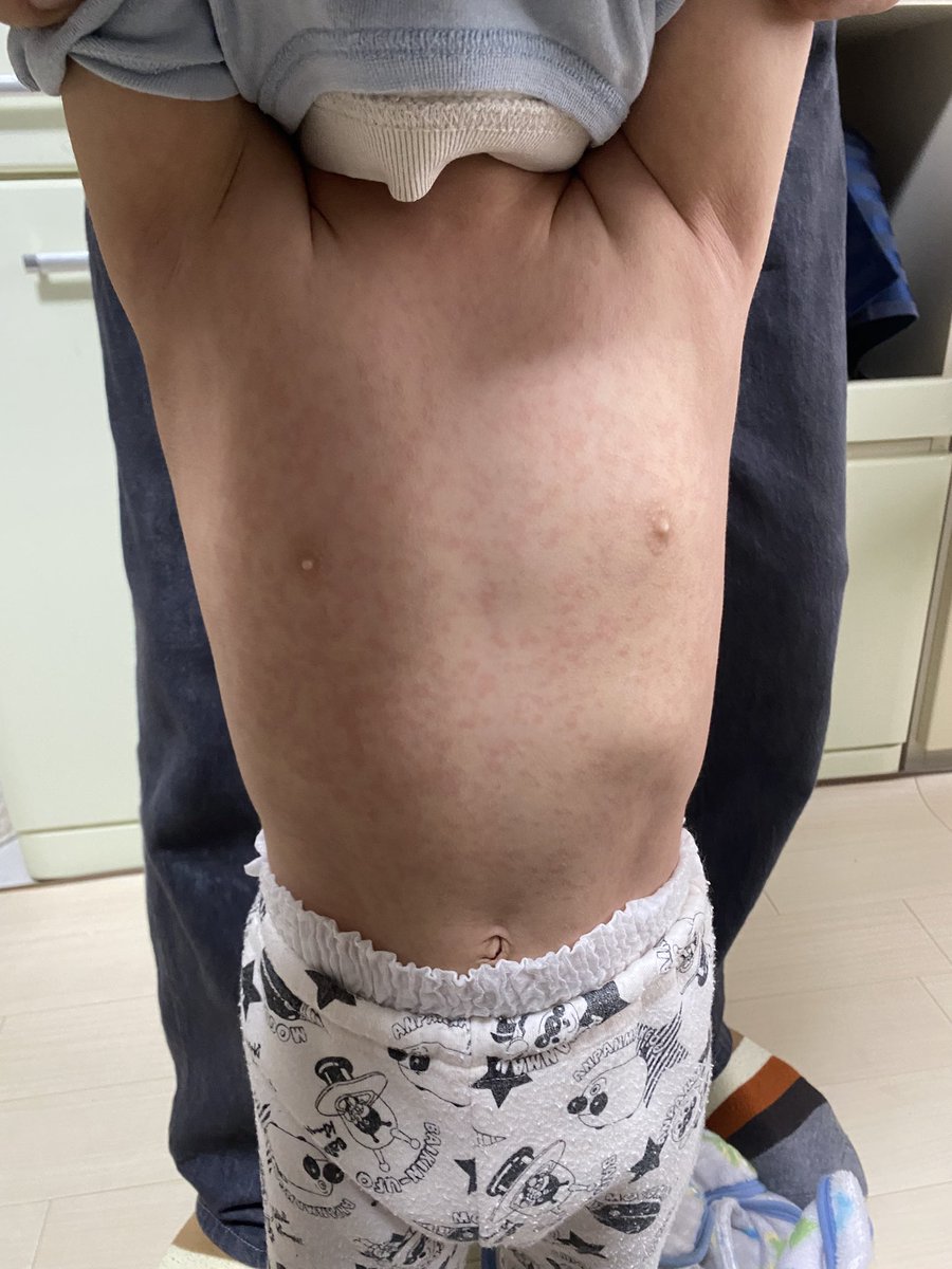 夏目りん🧸 tweet media