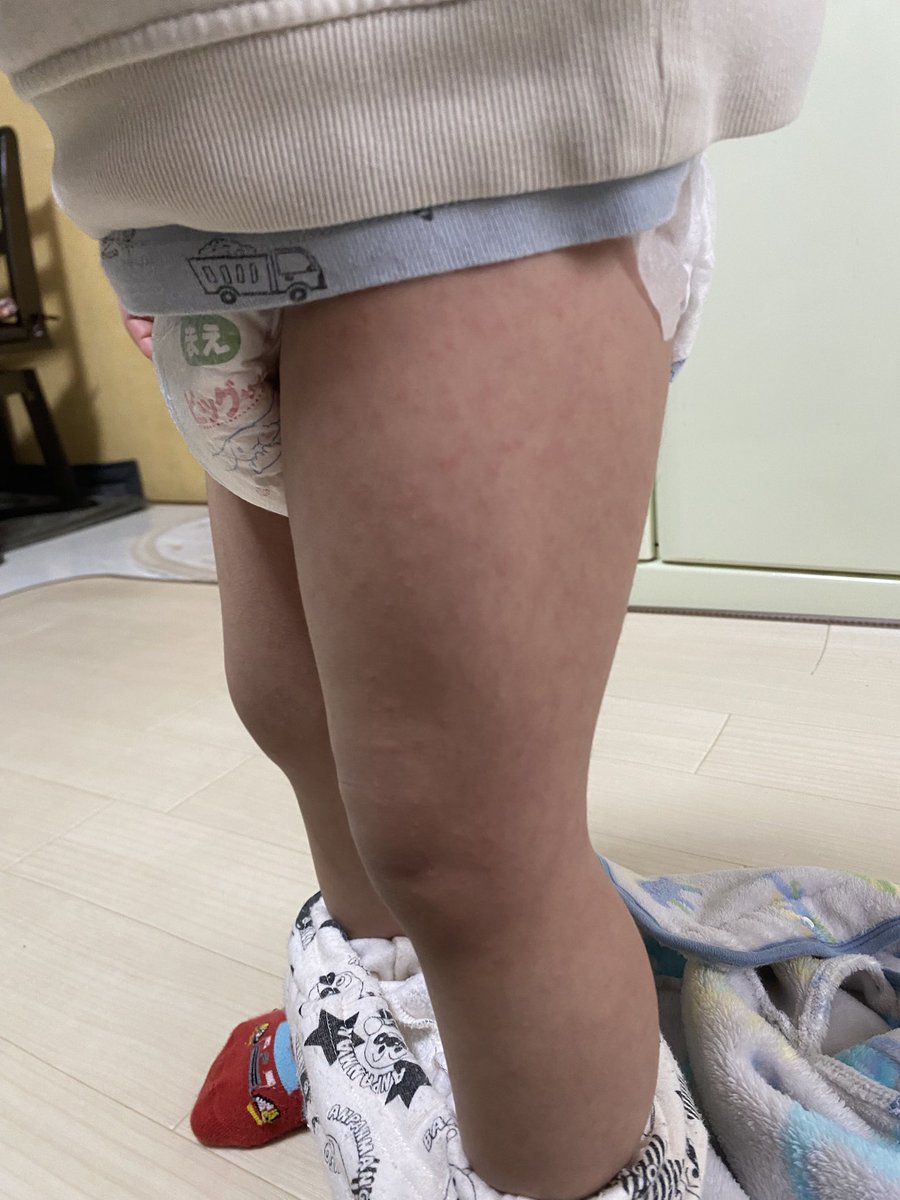 夏目りん🧸 tweet media