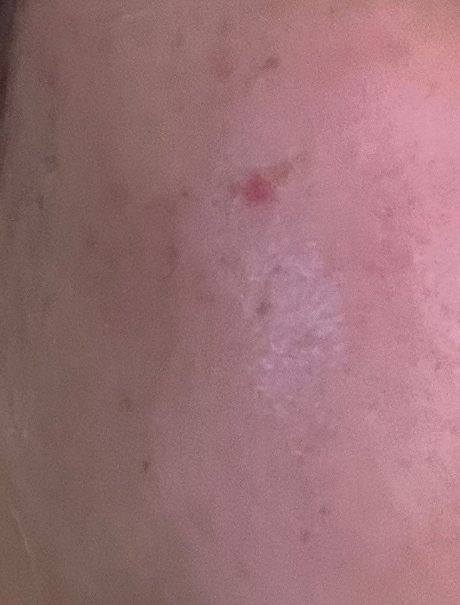 치에チエ tweet media