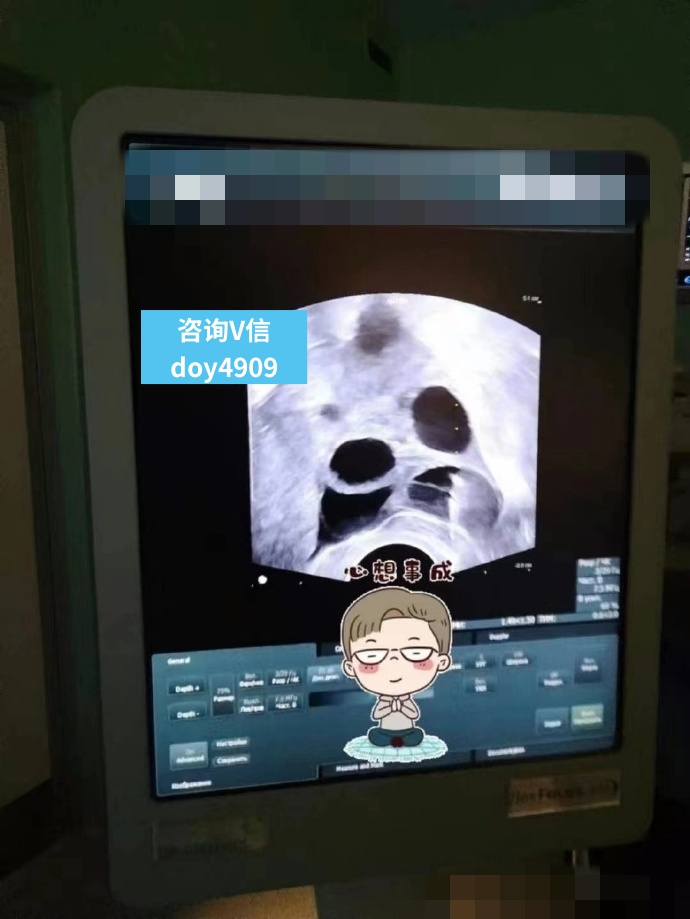 naple78116's tweet photo. 【US🇺🇸养囊11枚】已经有三娃的宝爸宝妈希望孩子越多越好，所以决定通过爱心代孕妈妈来帮助完成大家庭的计划，祝福11颗囊胚全部过检，多生几个宝宝。爱心妈妈已经选定，祝好孕！🙏

胖爸爸美国代孕 供精捐卵代孕 夫夫生子 妻妻试管婴儿 https://t.co/BmyHIiQPA6
