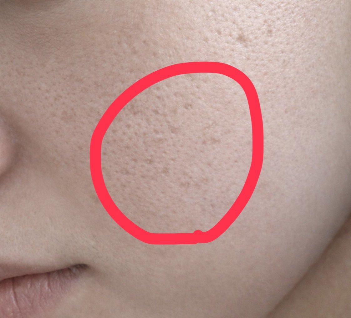 美容のムチ子 tweet media