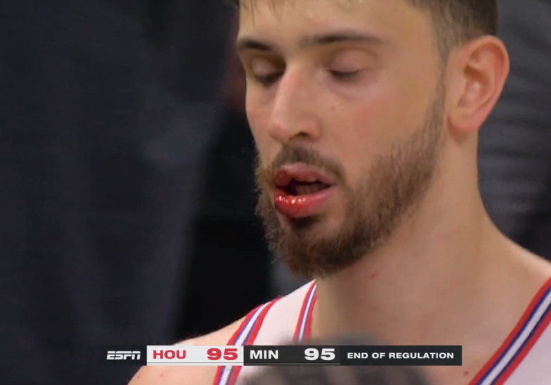 THIS GAME 🤯

Alperen Sengun makes game-saving block to send Rockets-Wolves to OT with a bloody lip!