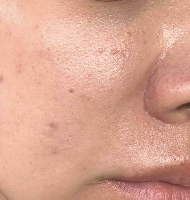 セリナ｜韓国コス🇰🇷 tweet media