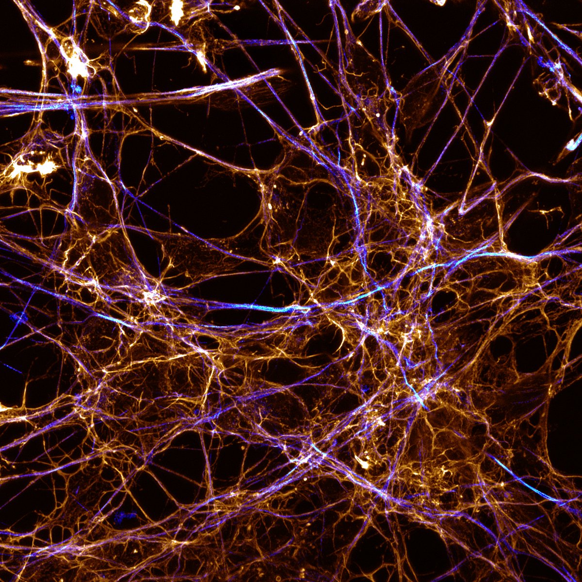 ibidiCells's tweet image. 🛣️ Cellular Highways 

A field of LUHMES-derived #neurons stained for actin (gold) &amp;amp; microtubules (cyan)

🔬Scientific #artwork by Joe McKellar from @CNRS,  @umontpellier

Published a neurobiology paper in 2025/2026 citing ibidi? 

Submit it here : zurl.co/fbbIO
#bioart
