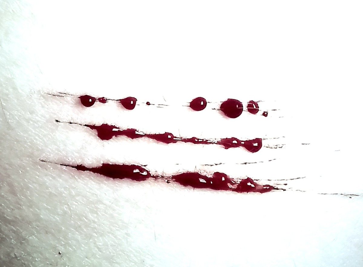 🐾 ⸝⸝ ⋆ yuu ,, #shedtwt tweet media