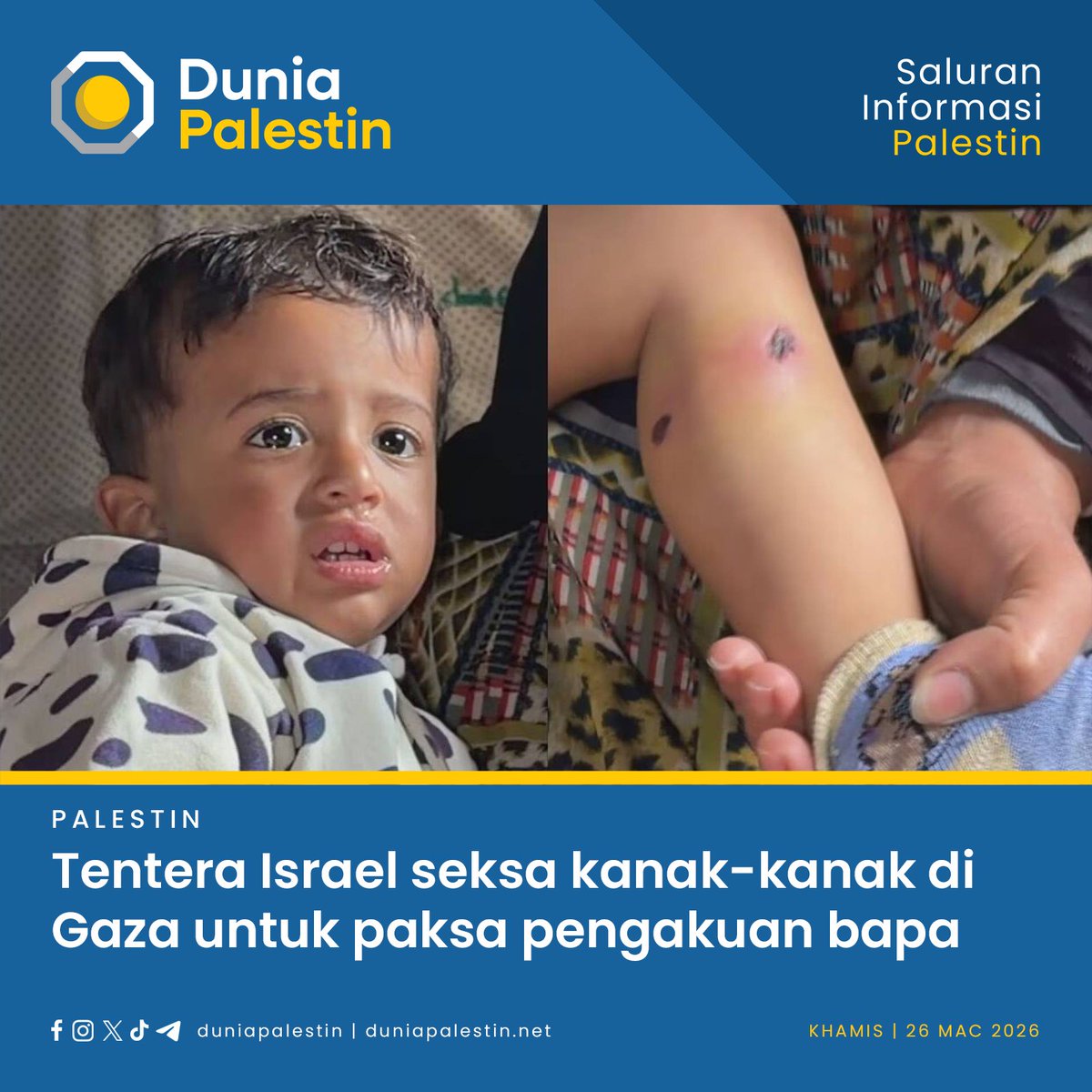 Sepanjang tempoh penahanan selama 10 jam, saksi melaporkan bahawa Karim mengalami penderaan fizikal yang teruk; tubuhnya didakwa dilecurkan dengan puntung rokok dan kukunya dikatakan digunakan untuk menimbulkan kesakitan.

Baca selanjutnya:
duniapalestin.net/palestin/5347/