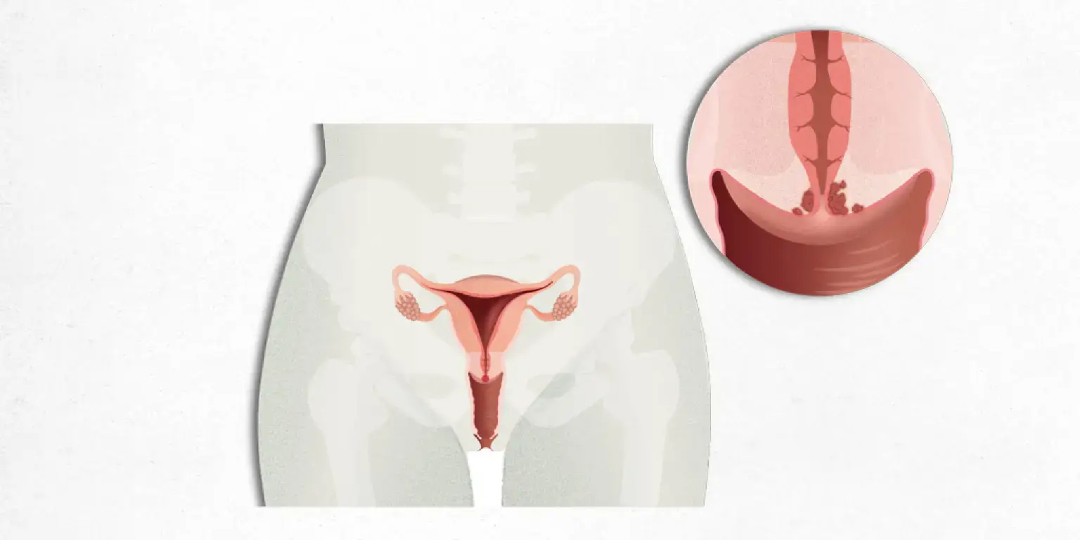 Hospital Clínic tweet media