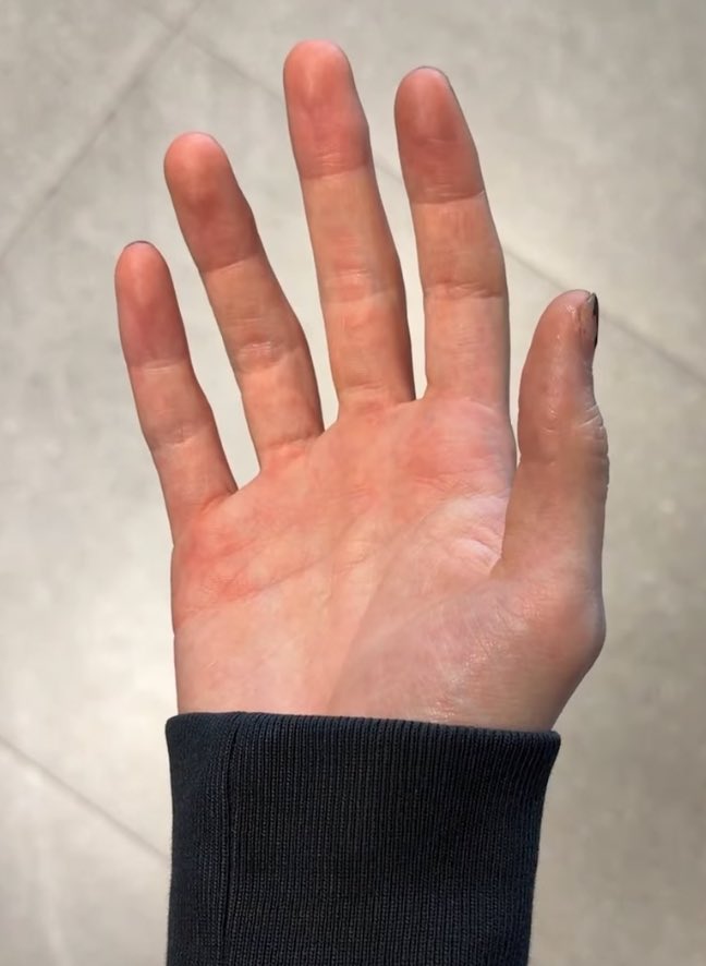 쭈윙크크 tweet media