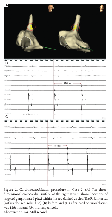 Brain & Heart - ASP tweet media