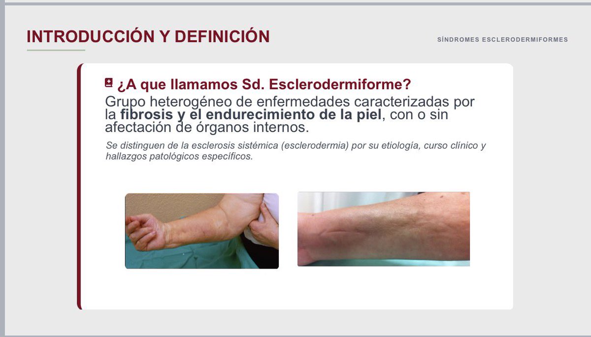 Reumatología Hospital Clínico de Valladolid tweet media