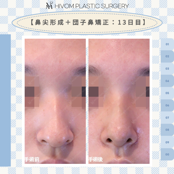 ハイボム美容外科🍑プチ整形🍑 tweet media