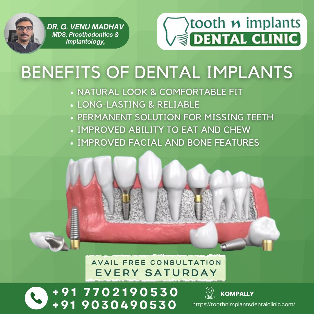 ToothnImplants's tweet image. #DentalImplants #ToothNImplants #KompallyDentist #DentalCare #SmileDesigning #Implantologist #DrVenuMadhav #BestDentistKompally #DentalClinicKompally #MissingTeethSolution #DentalFix #OralHealthMatters #LongLastingSmile #NaturalTeethFeel #ChewingMadeEasy #PermanentTeeth
