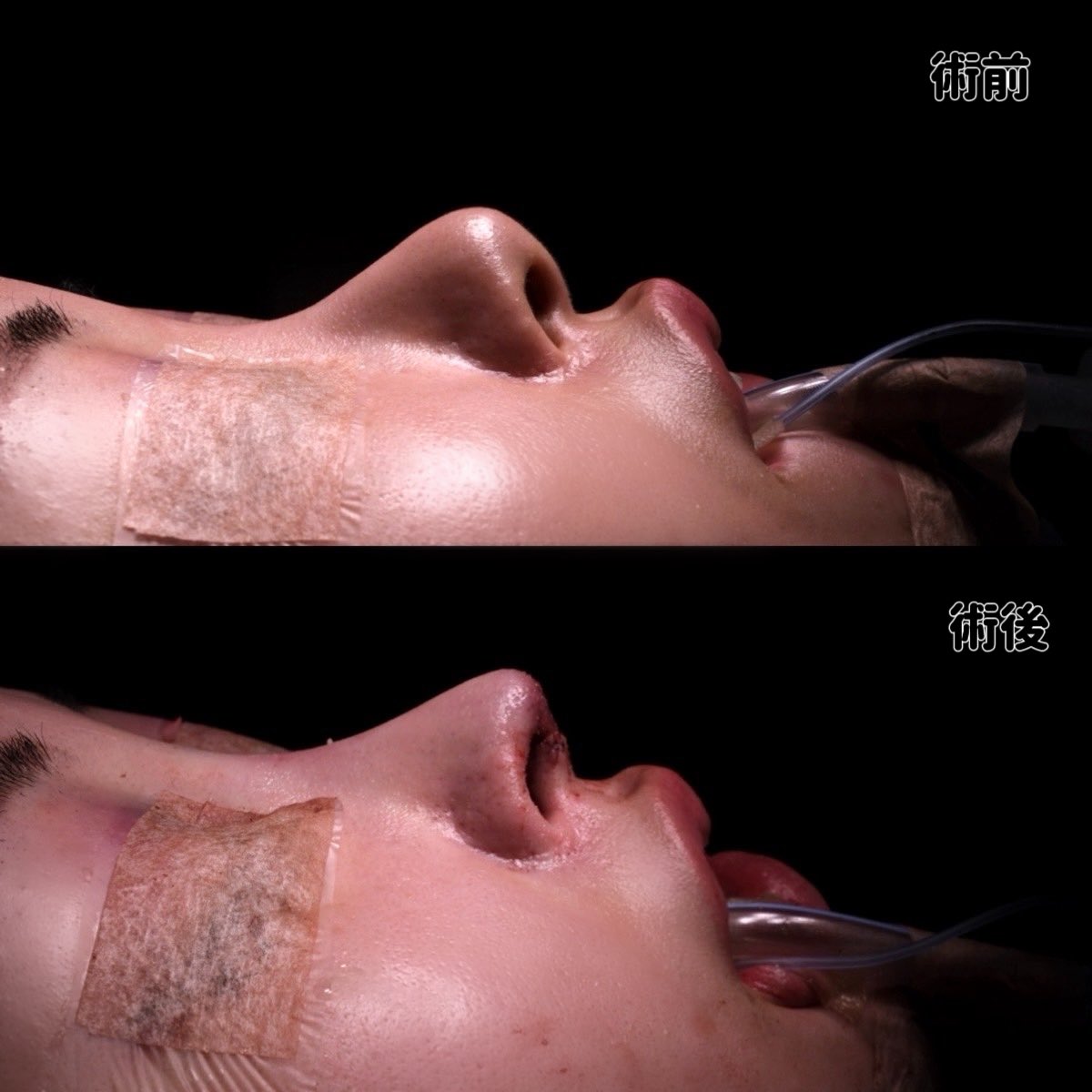 すずちゃん🫧 tweet media