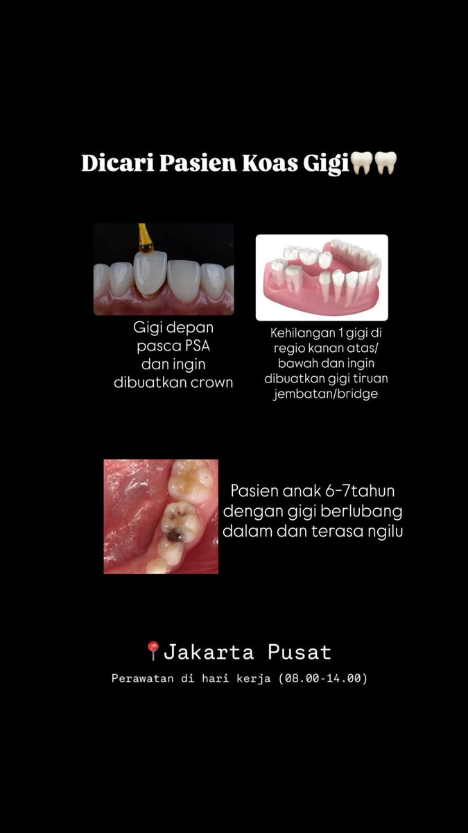 dev | Koas Gigi di Jakpus tweet media