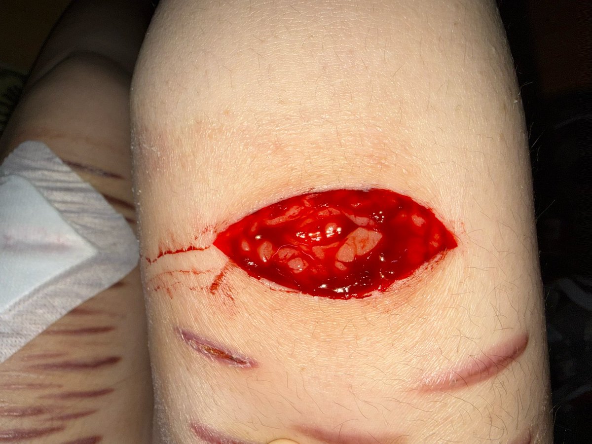 cold fish tweet media