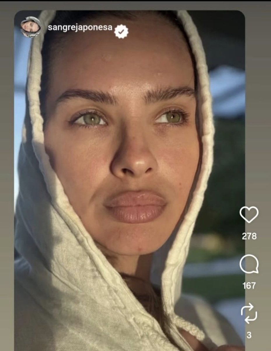 anabella tweet media