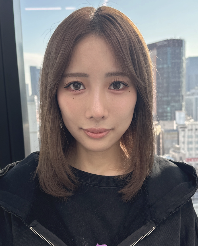 nagura_shunsuke's tweet photo. 嬉しいお言葉ありがとうございます！

ゆなさんの場合、鼻尖形成と脂肪注入を組み合わせたことで、お顔全体のバランスが劇的に整いました。

ゆなさんの今後の活躍を楽しみにしています✨ https://t.co/zGhbsrqRCq