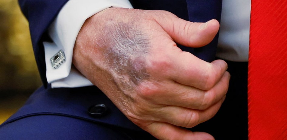 Hugo Sanchez PERU tweet media