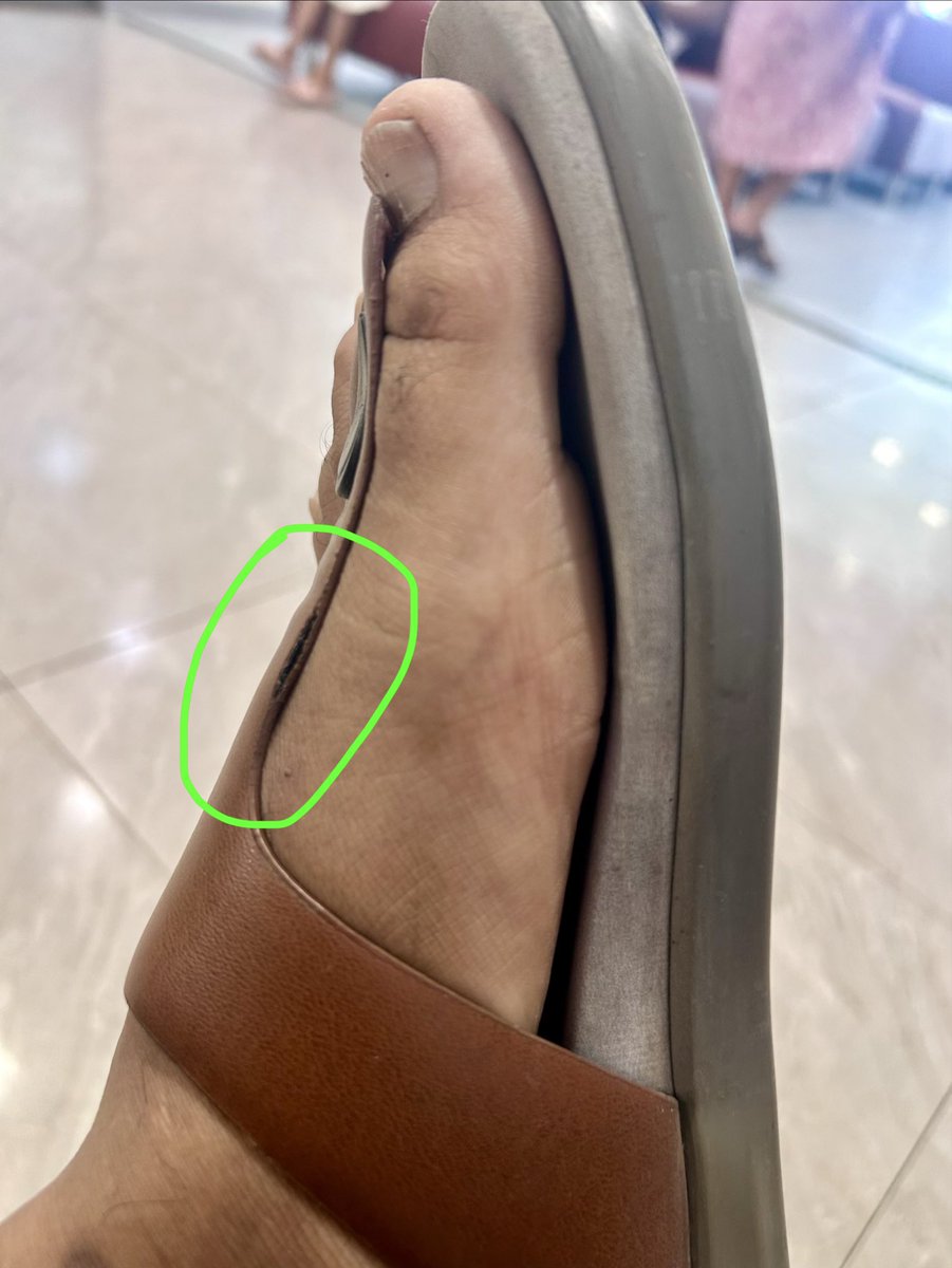 Aadie004's tweet photo. @ganeshsonawane Frido has low quality product, It’s been 3months I purchased Frido slipper and I have used minimally. Product is already getting peeled from the strips. 
@frido_official @ganeshsonawane https://t.co/Ee9PxGZ8TP