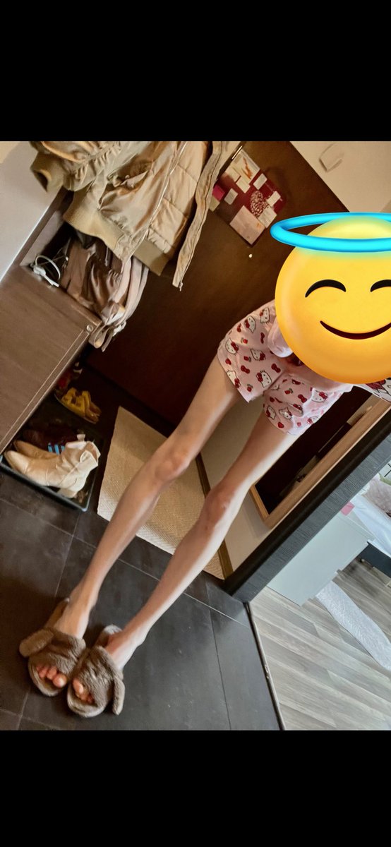 kaylor555's tweet photo. this bitch was calling herself fat… #edtwt https://t.co/HyOHUBw5cq
