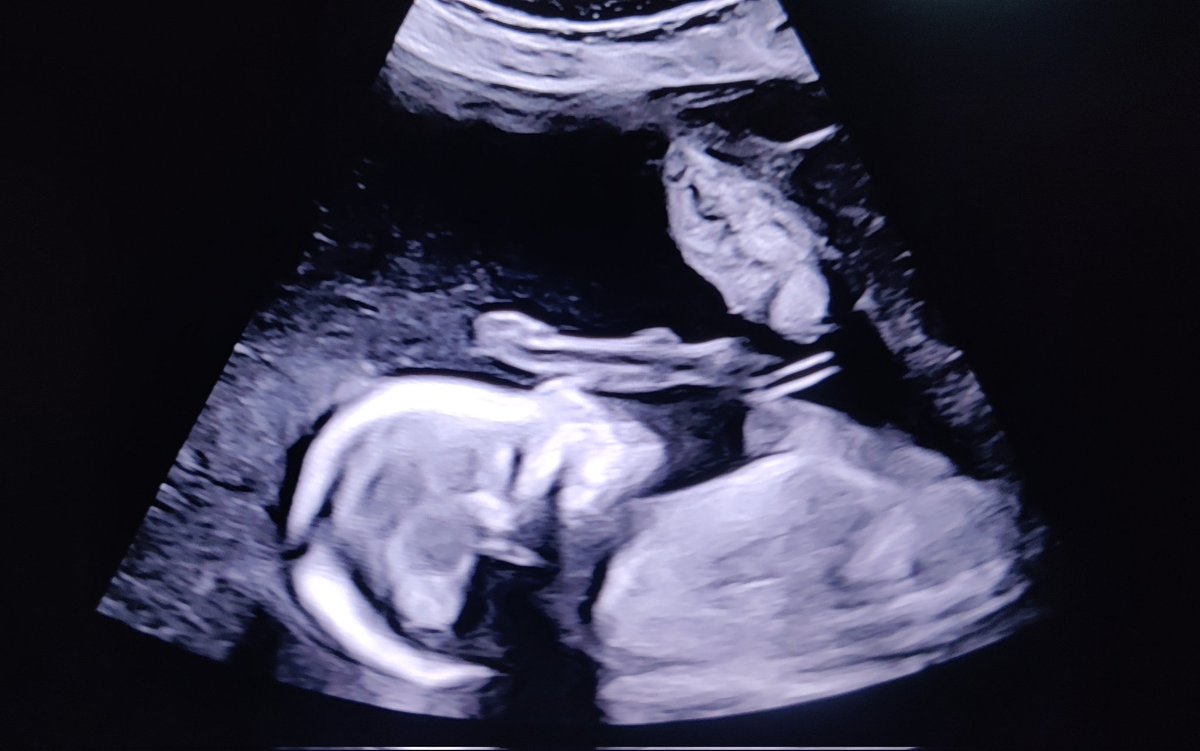 TheNameIsToby🎙️ tweet media